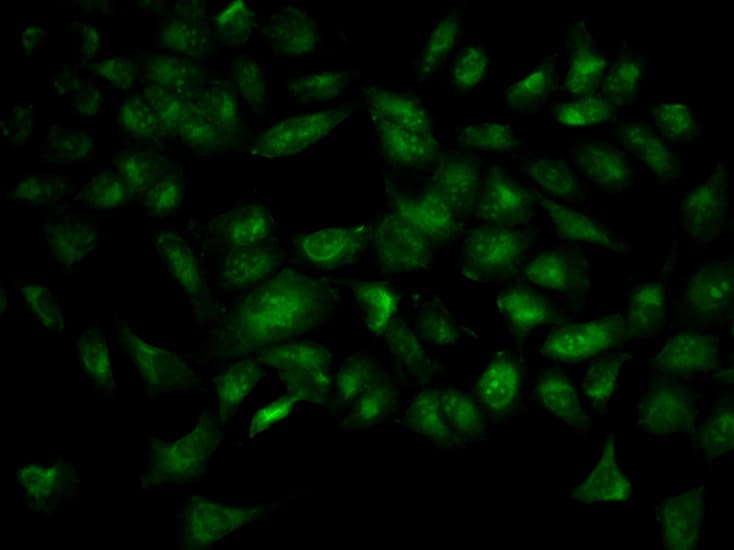 YWHAB / 14-3-3 Beta Antibody