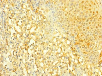 Polyclonal Rabbit anti-Human SLC4A7 Antibody (IHC, IF)