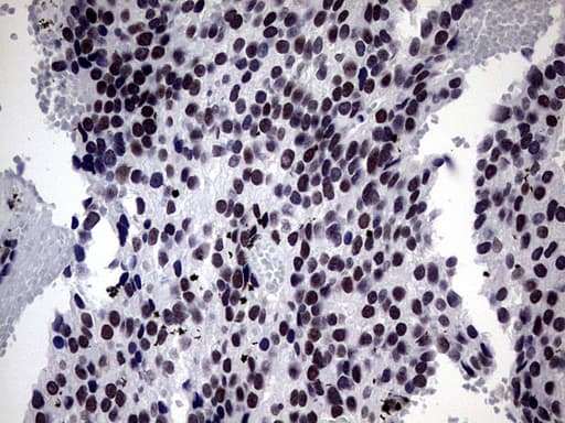 ZNF34 Antibody (aa117-405, clone OTI3G2, Carrier-free)
