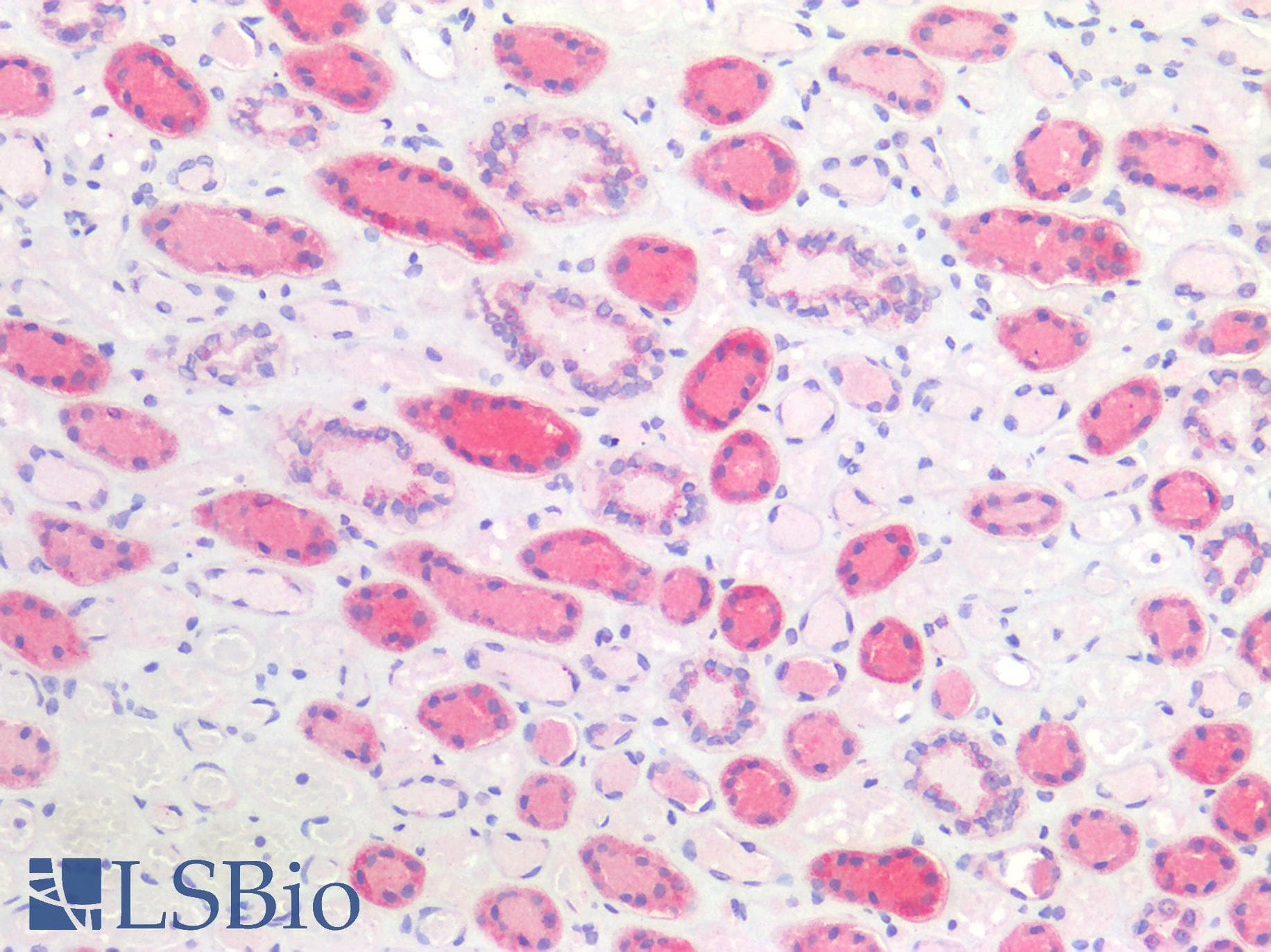 PathPlus™ Monoclonal Mouse anti-Human APCS / Serum Amyloid P / SAP Antibody (clone 7F3, IHC, WB)