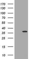 IHC-plus™ TS / Thymidylate Synthase Antibody (clone OTI2C3)