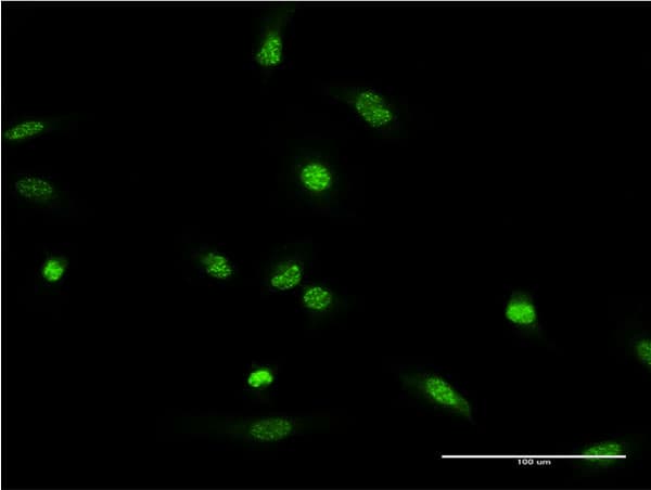 XRCC2 Antibody (clone 2H4)