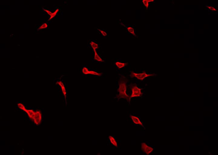 Peripherin Antibody (aa445-470)