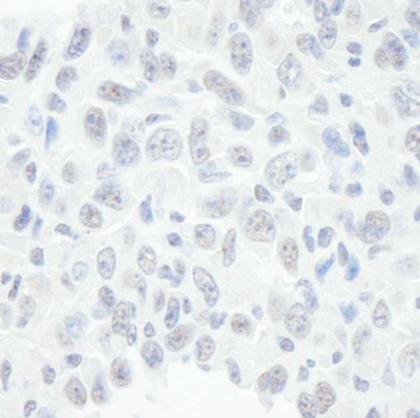 SMARCE1 / BAF57 Antibody (aa360-C-term)