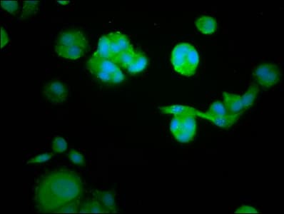 RASAL1 / RASAL Antibody