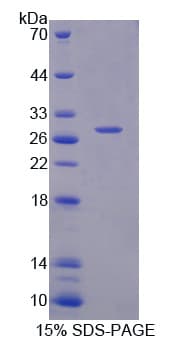 Mouse SH2B3 / LNK Protein (Recombinant His)