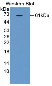 EPRS / PARS Antibody