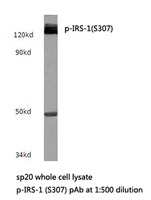 IRS1 Antibody (phospho-Ser307)