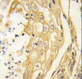 Polyclonal Rabbit anti-Human EPHB4 / EPH Receptor B4 Antibody (IHC, WB)