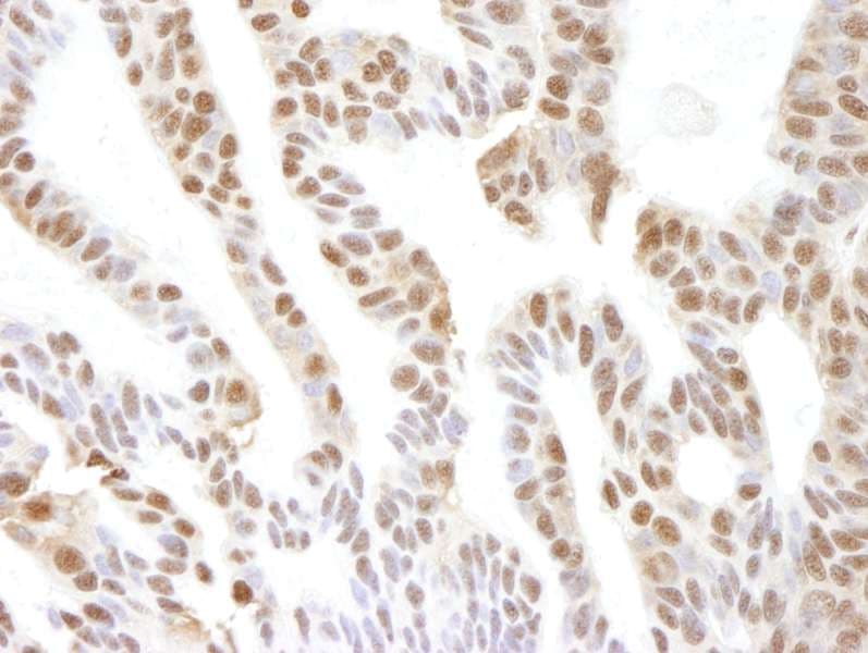 Polyclonal Rabbit anti-Human VCP Antibody (aa750-C-term, IHC)