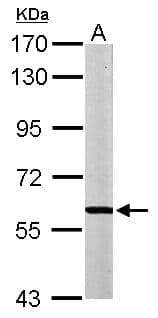 MPP2 Antibody (aa11-261)