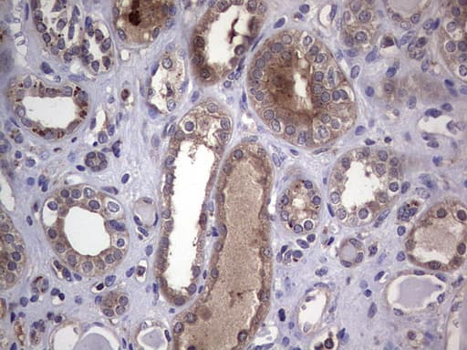 Monoclonal Mouse anti-Human CSNK1E / CK1 Epsilon Antibody (clone OTI5H10, aa153-416, IHC, WB)