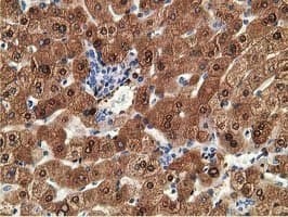 ADH2 / ADH1B Antibody (clone OTI1C3)