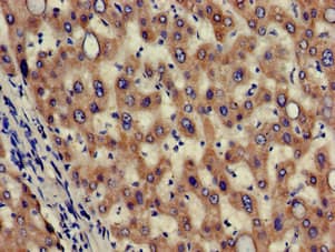 Polyclonal Rabbit anti-Human HAO2 Antibody (IHC, WB)