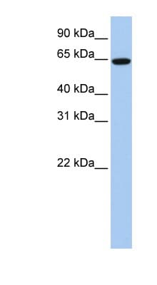 EPS8L1 Antibody (C-Terminus)
