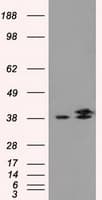 IDH3A Antibody (clone OTI2F11)