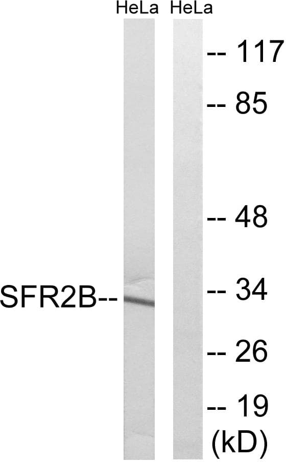 Polyclonal Rabbit anti-Human SRSF8 Antibody (aa31-80, WB)