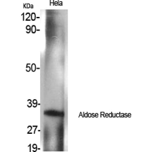 AKR1B1 / Aldose Reductase Antibody (210-290 aa, C-terminal)