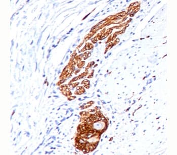 NCAM / CD56 Antibody (clone 123C3.D5, Azide-free)