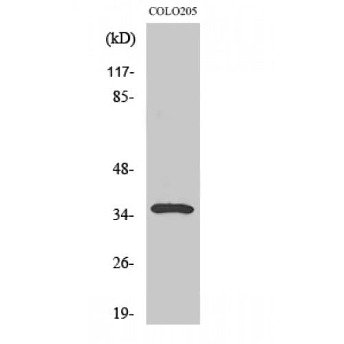 GAL4 / Galectin 4 Antibody (30-110 aa, Internal)