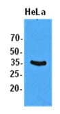 IHC-plus™ Monoclonal Mouse anti-Human EIF2S1 Antibody (clone AT5E10, IHC, WB)