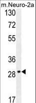 Polyclonal Rabbit anti-Human OR9Q1 Antibody (aa279-308, IHC, WB)