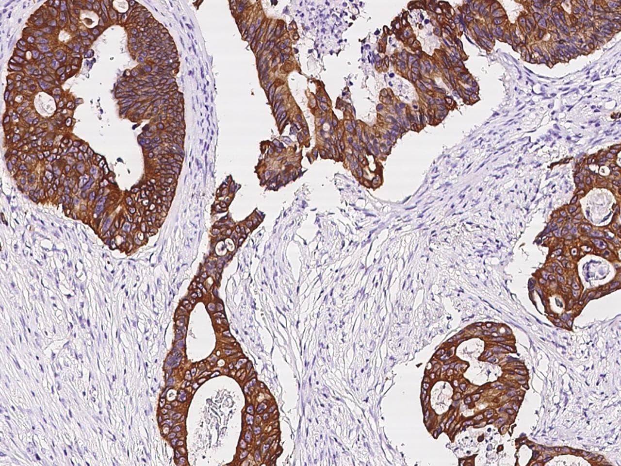 KRT8 / CK8 / Cytokeratin 8 Antibody (Preservative Free)