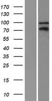 ZBTB33 / Kaiso Protein (Over-Expression Lysate Myc-DDK (Flag))