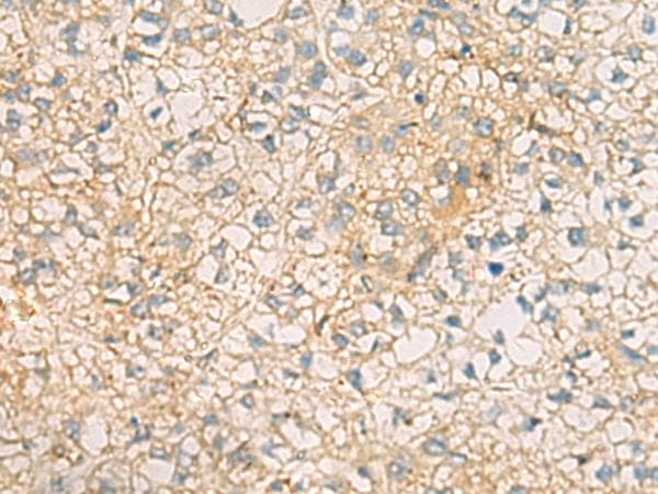 MRPL9 Antibody