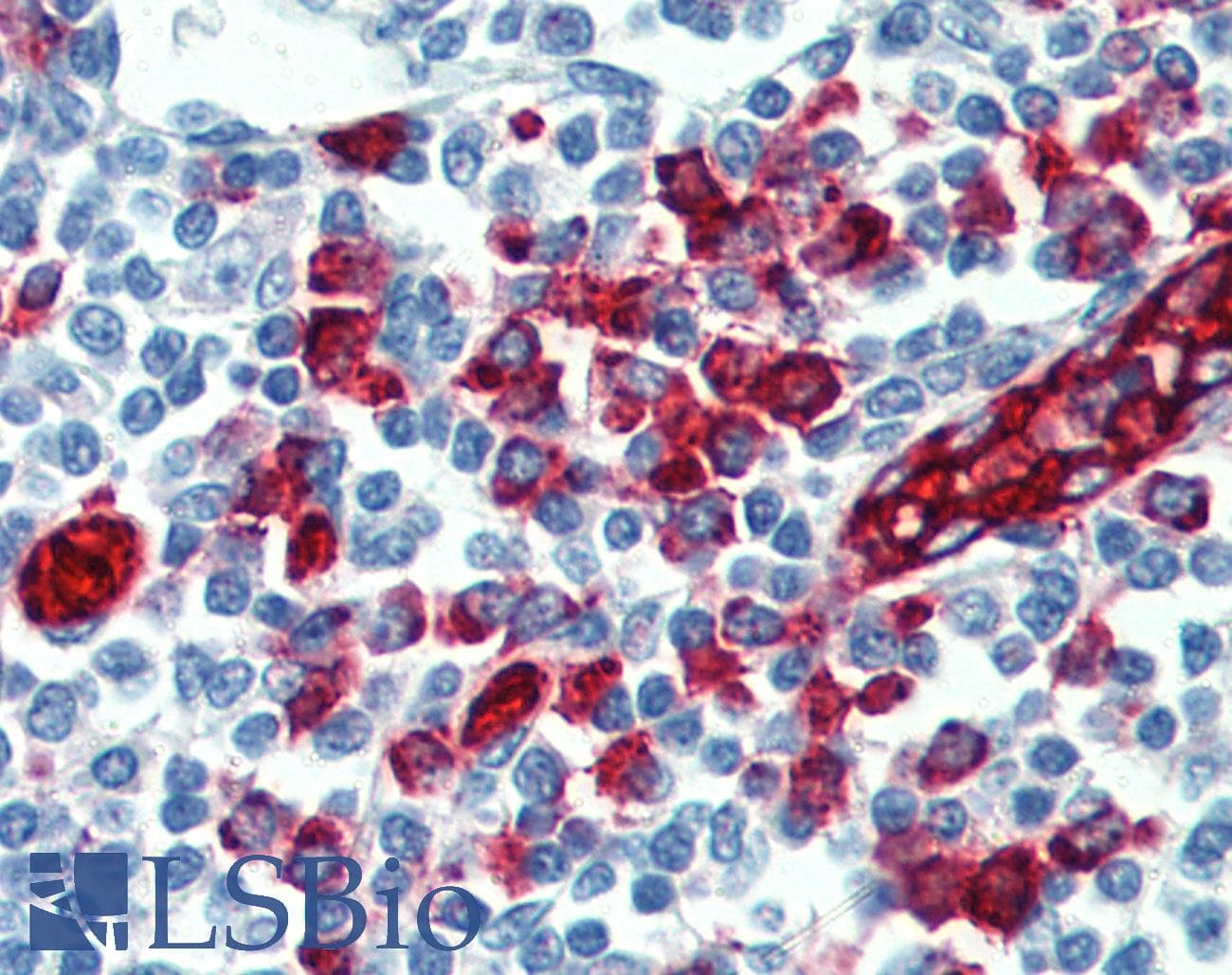 IHC-plus™ SELPLG / PSGL-1 / CD162 Antibody (clone HECA-452)
