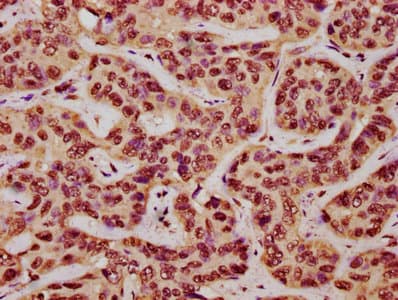 DVL2 / Dishevelled 2 Antibody (aa1-240)