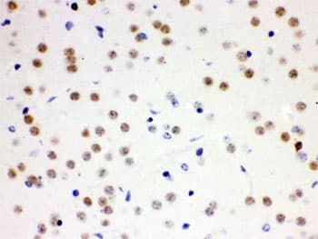 CDC25B Antibody