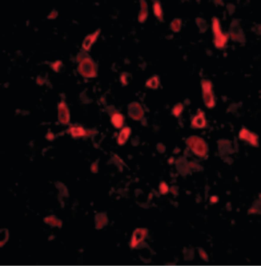 IHC-plus™ TSLP Antibody