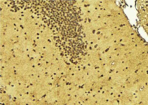 ZBTB40 Antibody