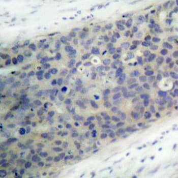 Polyclonal Rabbit anti-Human LIMK2 Antibody (phospho-Thr505, IHC, IF, WB)