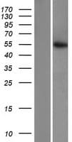 Human CS / Citrate Synthase Protein (Over-Expression Lysate Myc-DDK (Flag))