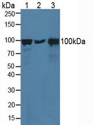 CTNNA1 / Catenin Alpha-1 Antibody (aa2-228)