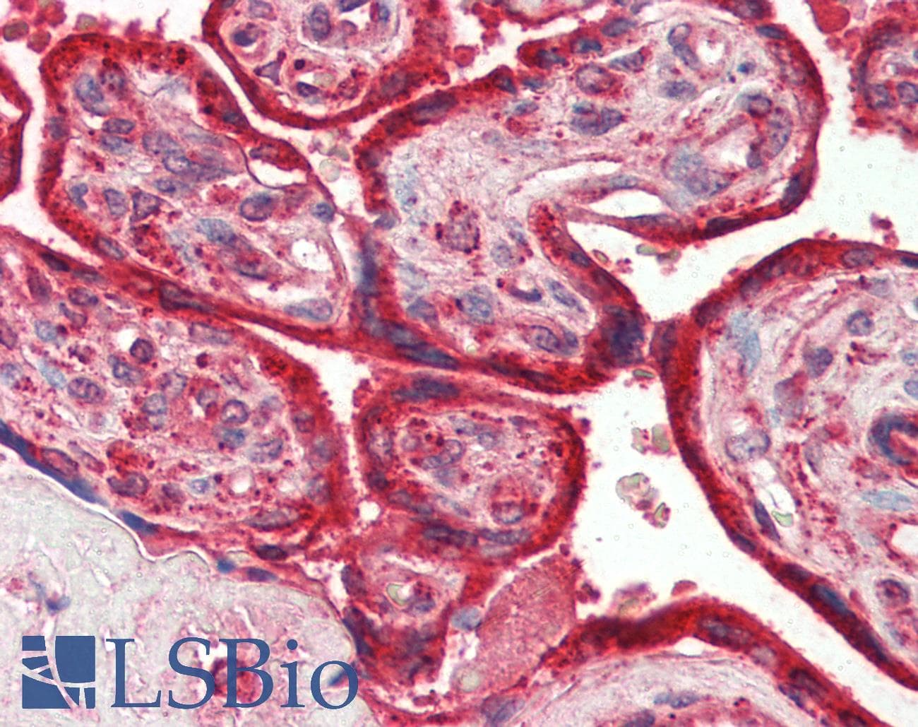 IHC-plus™ Monoclonal Mouse anti-Human CALR3 Antibody (clone 1G6A7, IHC, IF, WB)