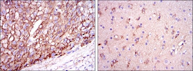 APOE / Apolipoprotein E Antibody (clone 1H4)