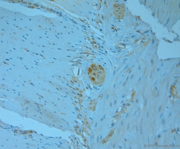 Polyclonal Rabbit anti-Human REEP5 Antibody (aa150-189, IHC)
