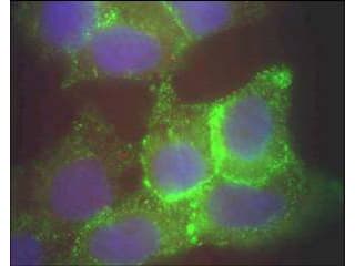 Polyclonal Rabbit anti-Human JAG1 / Jagged 1 Antibody (N-Terminus, IHC, IF, WB)