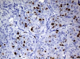 Monoclonal Mouse anti-Human MKI67 / Ki67 Antibody (clone OTI3B6, IHC)