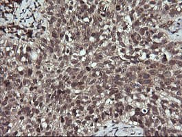 Monoclonal Mouse anti-Human ANAPC11 / APC11 Antibody (clone OTI1F2, IHC, WB)