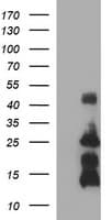 TNF Alpha Antibody (clone OTI1C1)