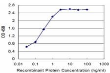 IHC-plus™ SCML1 Antibody (clone 4G3)