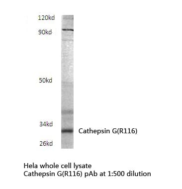 PathPlus™ CTSG / Cathepsin G Antibody (aa71-120)