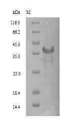 Human SIRPG Protein (Recombinant 6His, N-terminus)