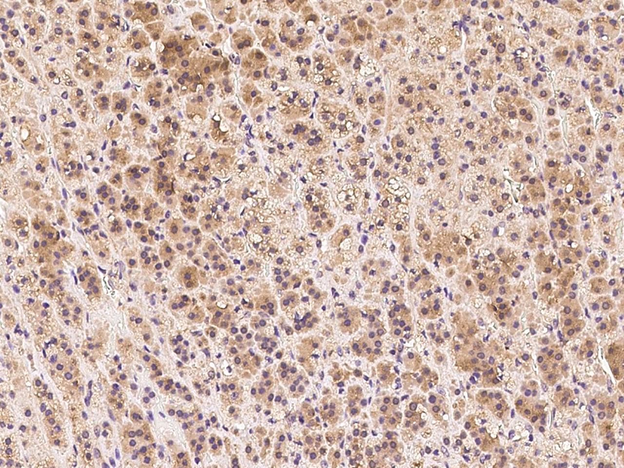 Polyclonal Rabbit anti-Human CLTC / Clathrin Heavy Chain Antibody (IHC, WB)