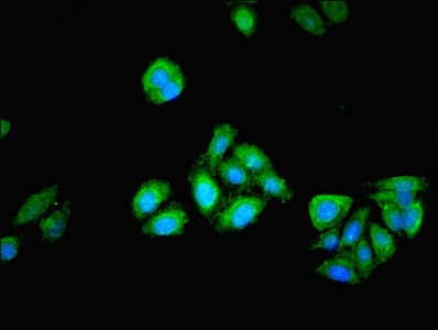 PGM1 / Phosphoglucomutase 1 Antibody (aa1-562)