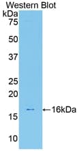 LGALS7 / Galectin 7 Antibody (aa1-128)